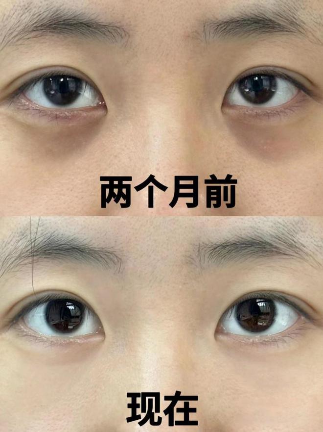 小绿管眼霜效果、肤感一流的眼霜解析AG旗舰厅登录首页广受好评的初源漾(图2)